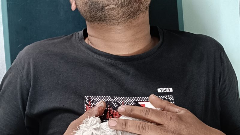 বরিশাল নগরীতে এক যুবককে পিটিয়ে আহত করেছে প্রতিপক্ষরা