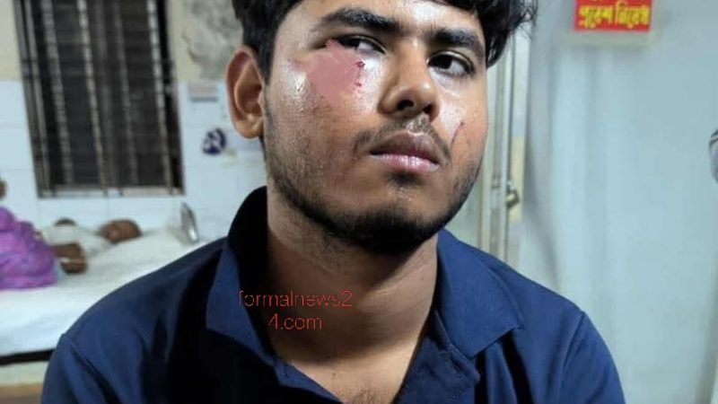 ববি শিক্ষার্থীকে মা*র*ধর করে সবকিছু ছিনিয়ে নিল দু*র্বৃত্তরা